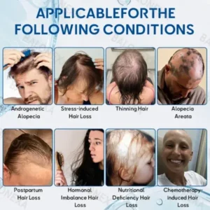 𝙎𝙏𝙀𝙈 𝘾𝙚𝙡𝙡 𝙃𝙖𝙞𝙧 𝘾𝙮𝙘𝙡𝙚 𝙍𝙤𝙡𝙡𝙚𝙧