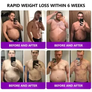 𝑵𝒂𝒏𝒐 𝑴𝒊𝒄𝒓𝒐𝒏𝒆𝒆𝒅𝒍𝒆 𝑺𝒍𝒊𝒎𝒎𝒊𝒏𝒈 𝑷𝒂𝒕𝒄𝒉