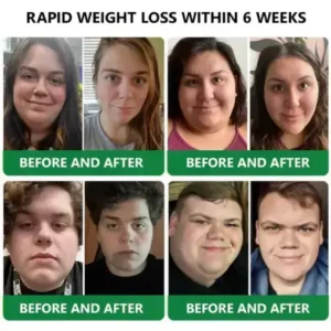 𝑵𝒂𝒏𝒐 𝑴𝒊𝒄𝒓𝒐𝒏𝒆𝒆𝒅𝒍𝒆 𝑷𝒂𝒕𝒄𝒉