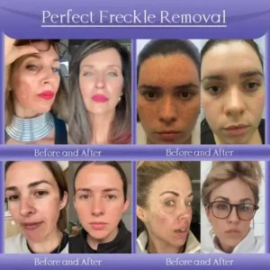 Anti-Wrinkle Skin Cream for Remove Wrinkles