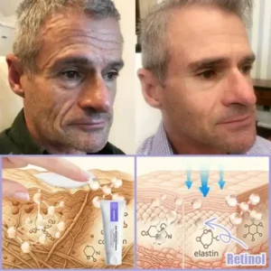 Anti-Wrinkle Skin Cream for Remove Wrinkles