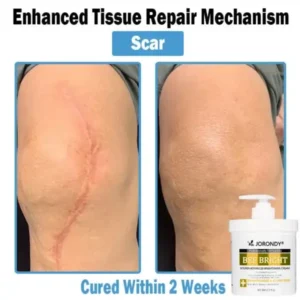 Bee Bright Multi-Symptom Skin Treatment Cream