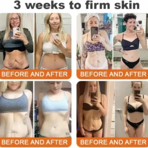 Bee Toxin Lift Cream