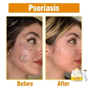 Bee Venom Comprehensive Cream