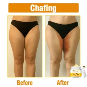 Bee Venom Comprehensive Cream