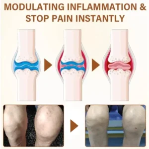 BoomTimilk® MagniBee Vital Joint Comfort Spray