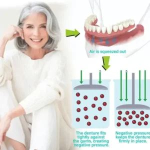 Immediate Dentures: The Ultimate Fit You Can’t Resist!