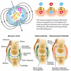 Lymphatic magnetic therapy cats eye ring