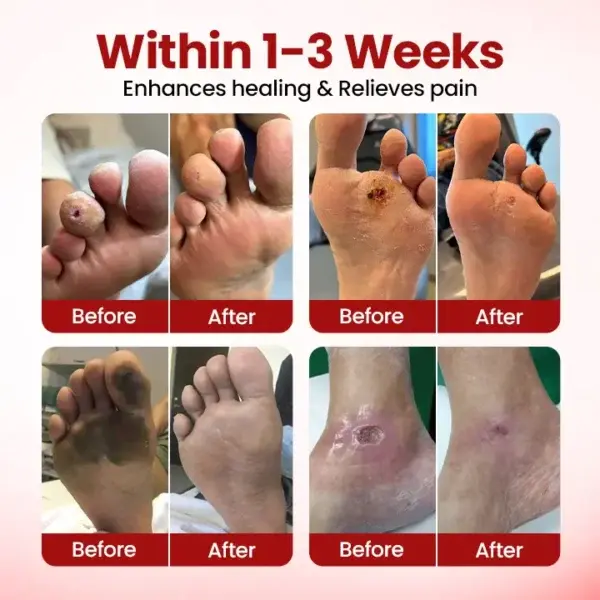 VitaGluco Diabetic Care Cream