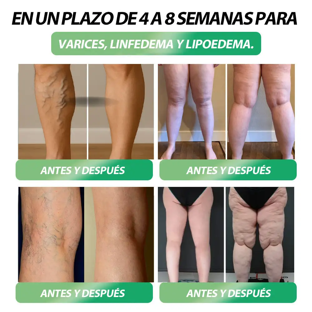 ๐
๐ข๐ญ & ๐๐ข๐ญ๐๐ฅ 8 en 1 ๐๐จ๐ฅ๐ฎ๐๐ขรณ๐ง ๐๐ซ๐๐ฅ - Image 5