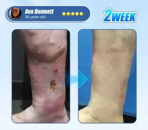 Diabetic Skin Revolution - Image 4