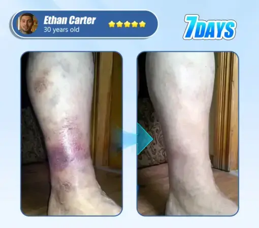 Diabetic Skin Revolution – 6-IN-1 Clinical Solution Black Fridey - Image 2