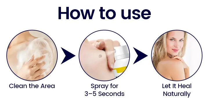 BBOJI WartErase Cryo Freeze Spray - Image 9