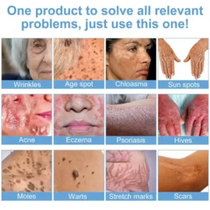 Alternative view of Bee Bright Multi-Symptom Skin Treatment Cream