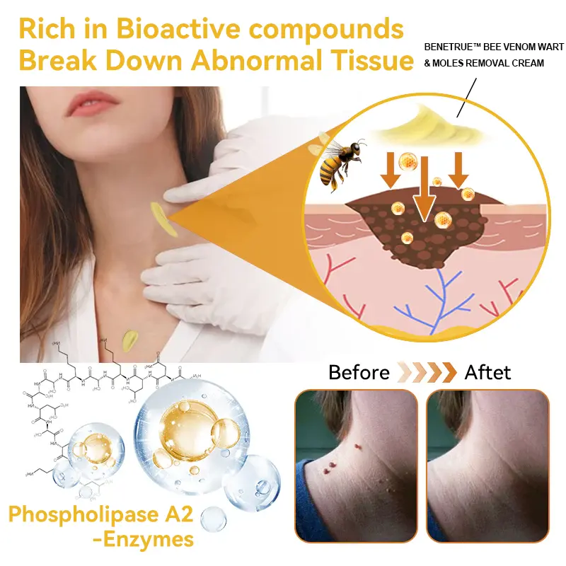 Bee Venom Wart & Moles Removal Cream - Image 15