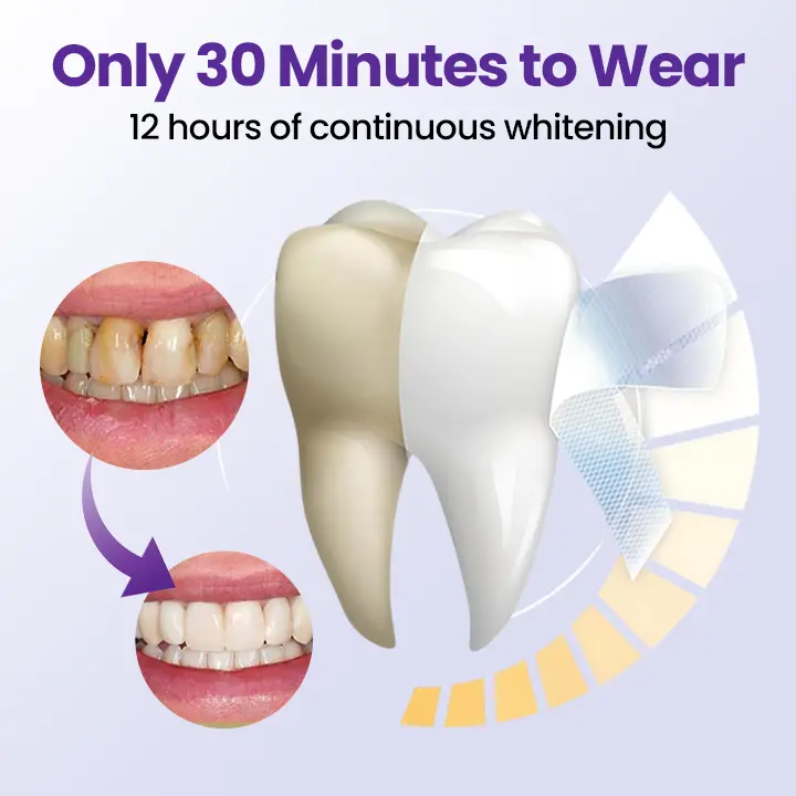 5D Teeth Whitening Strips - Image 6