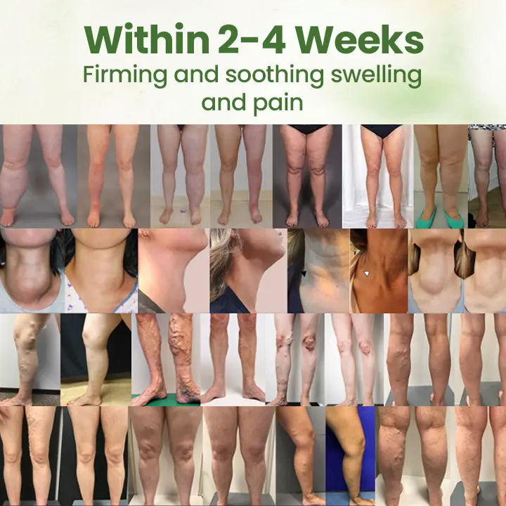 Lymphatic Detox Herbal Cream - Image 2