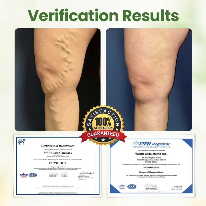 Lymphatic Detox Herbal Cream - Image 3