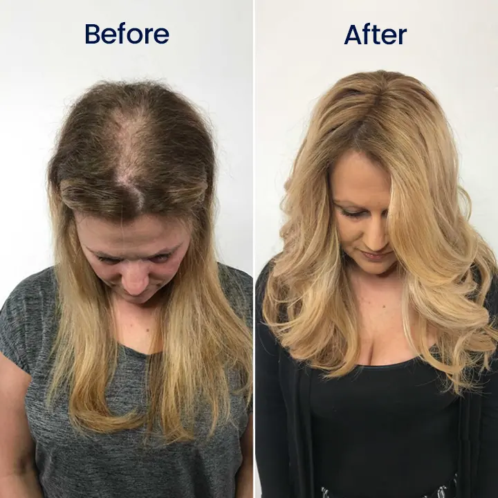 Maximum Strength 5% Minoxidil Fast-Action Hair Growth Serum - Image 4