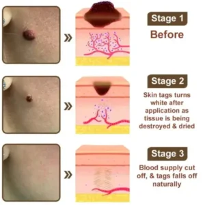 Black Rice Skin Repair Essence Cream