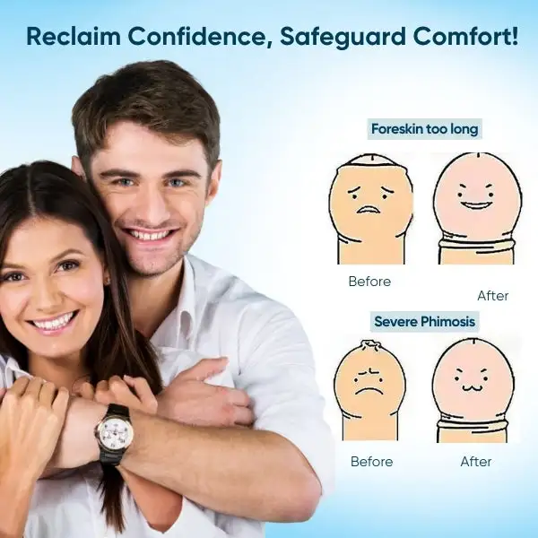 Redundant Prepuce Corrector Gel - Image 6