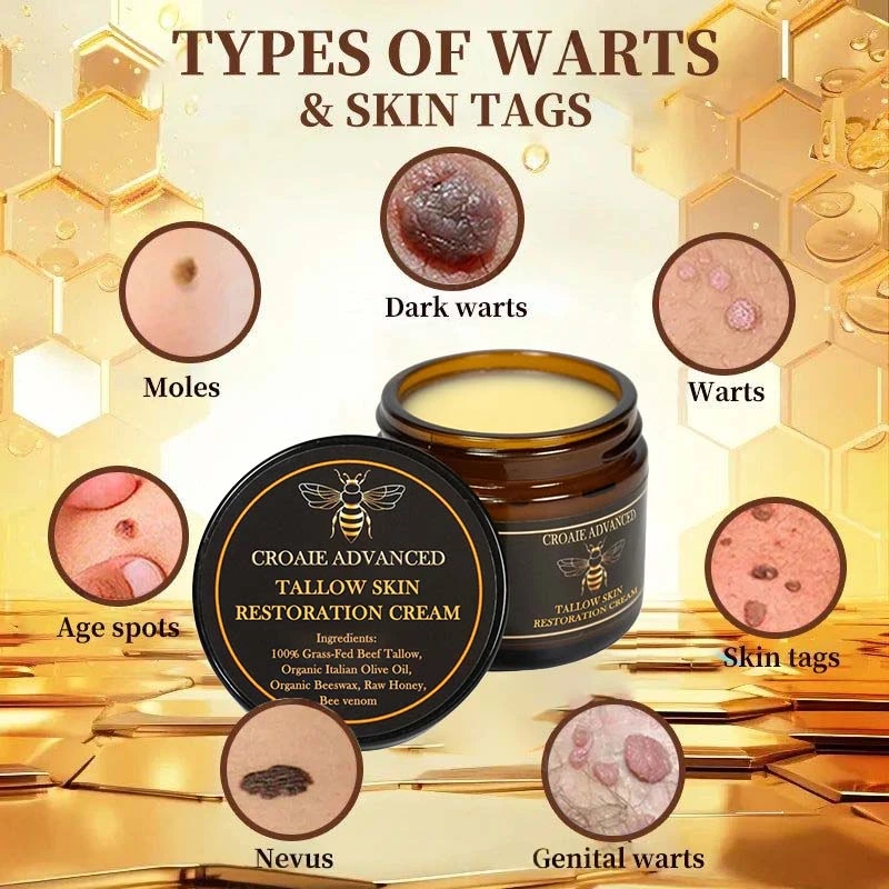 CROAIE 𝐏𝐬𝐨𝐫𝐢𝐚𝐬𝐢𝐬 & 𝐄𝐜𝐳𝐞𝐦𝐚 𝐑𝐞𝐥𝐢𝐞𝐟 𝐂𝐫𝐞𝐚𝐦 - Image 9