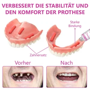 Alternative view of Thermischer Prothesenkleber