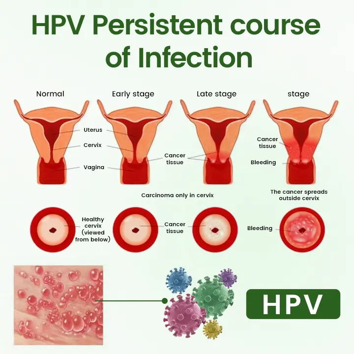 FeminaDefend All-In-One Intimate Therapy Pads - Image 4