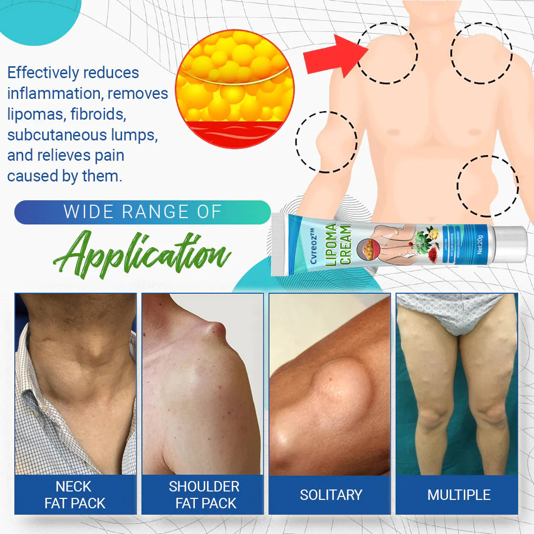 Cvreoz Lipoma Removal Cream - Image 8