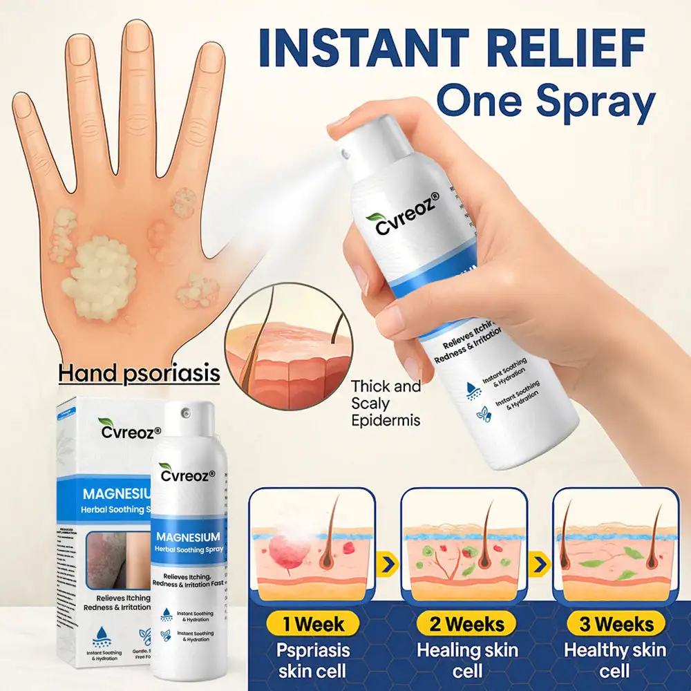 Magnesium Herbal Psoriasis Spray - Image 5