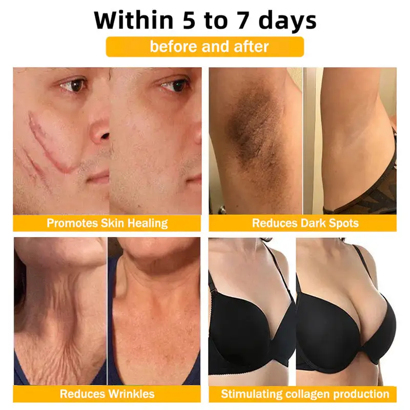 Lymphatic Magnetic Therapy Cross Design Diamond Necklace - Image 12