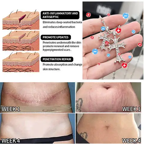 Lymphatic Magnetic Therapy Cross Design Diamond Necklace - Image 8