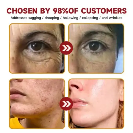 Botox Bee Venom Anti-Aging Wrinkle Serum - Image 5