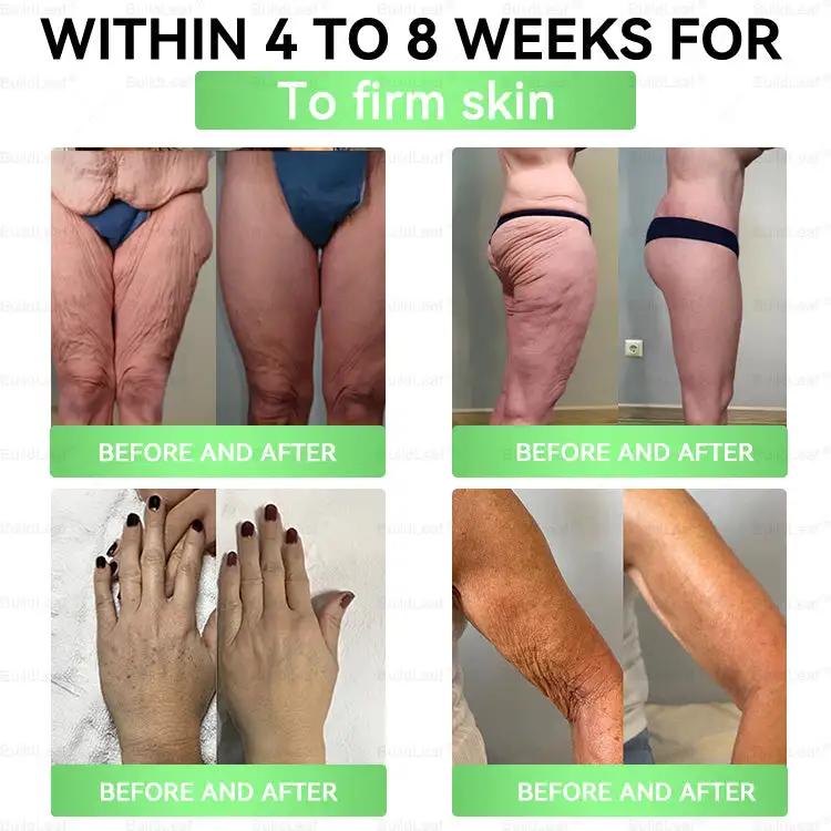 GL𝐏-1 8-𝒊𝒏-1 𝙁𝙞𝙩 & 𝙑𝙞𝙩𝙖𝙡 𝖮𝗋𝖺𝗅 𝙎𝙤𝙡𝙪𝙩𝙞𝙤𝙣 - Image 7