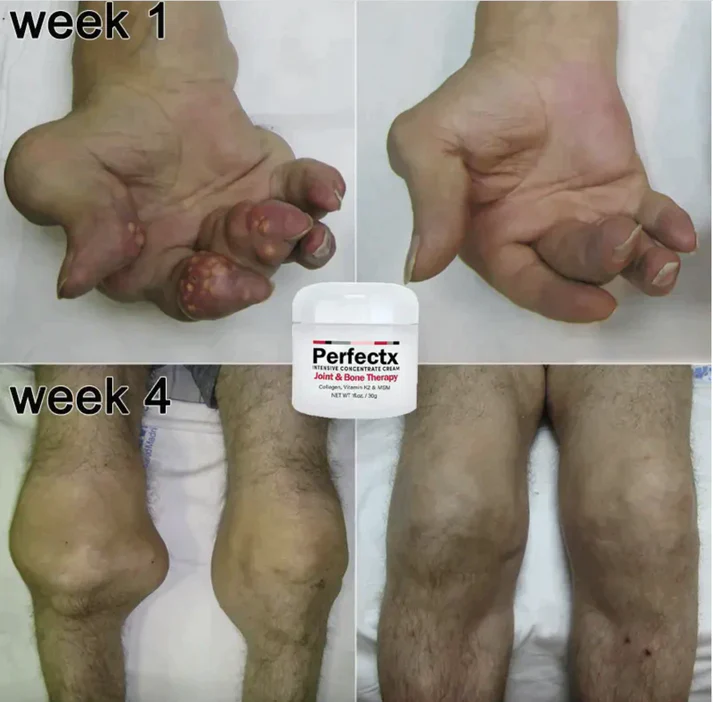 Perfectx Joint And Bone Therapy Cream - Image 4