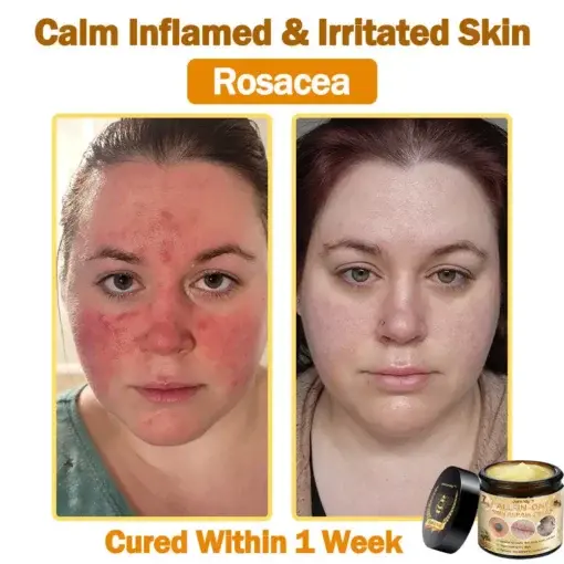 All-in-One Cream - Image 5