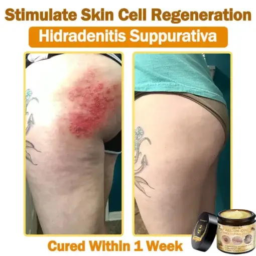 All-in-One Cream - Image 9