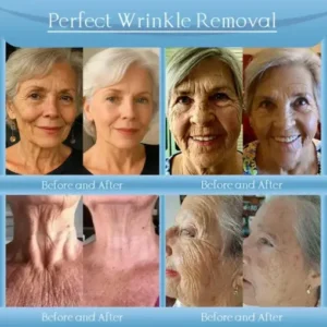 Alternative view of Anti-Wrinkle Skin Cream