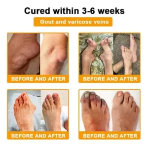 Alternative view of Bee Venom Pain-Relief Bone Healing Spray