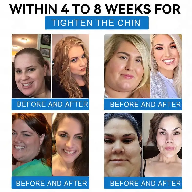 Nano Microneedle Weight Loss Patch - Image 6