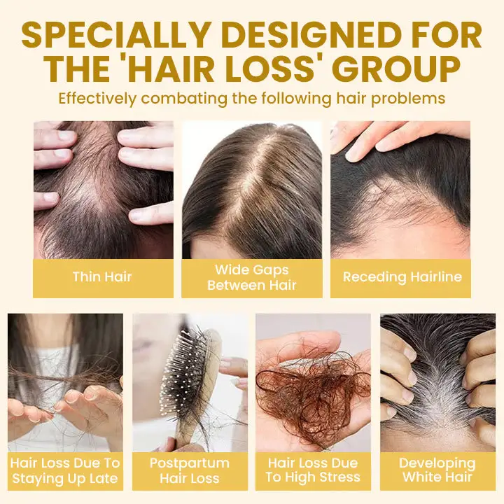 Spray-on Hair Growth Essence - Image 10