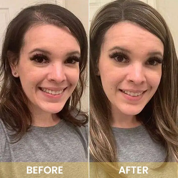 Spray-on Hair Growth Essence - Image 16