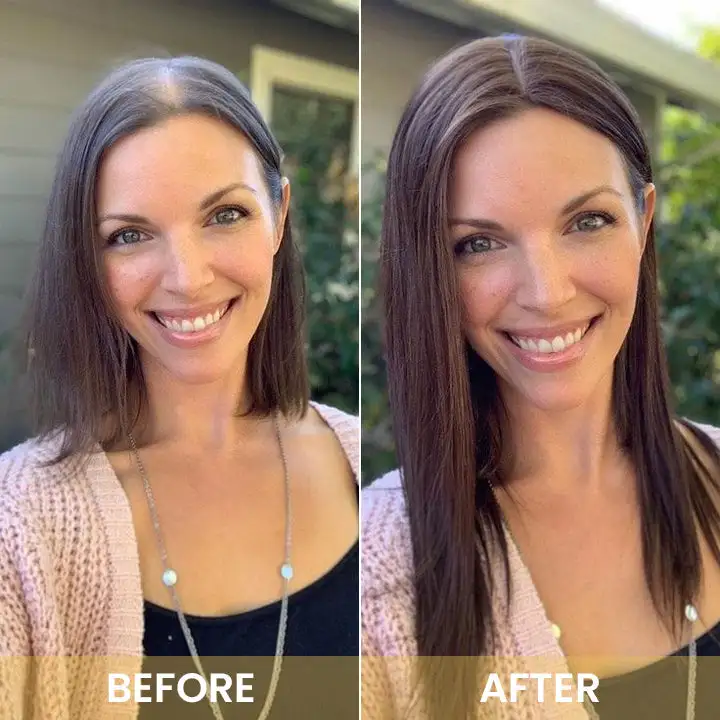 Spray-on Hair Growth Essence - Image 17