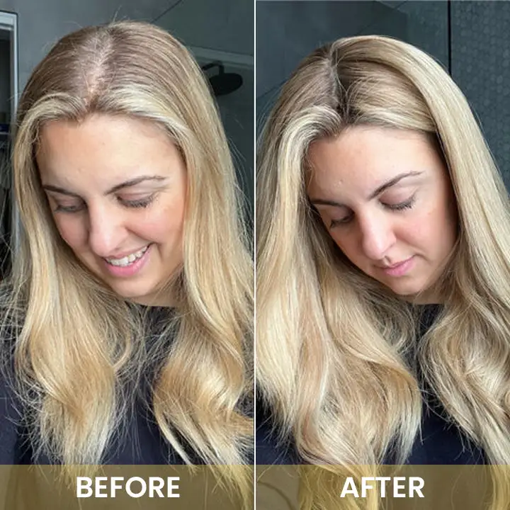 Spray-on Hair Growth Essence - Image 18