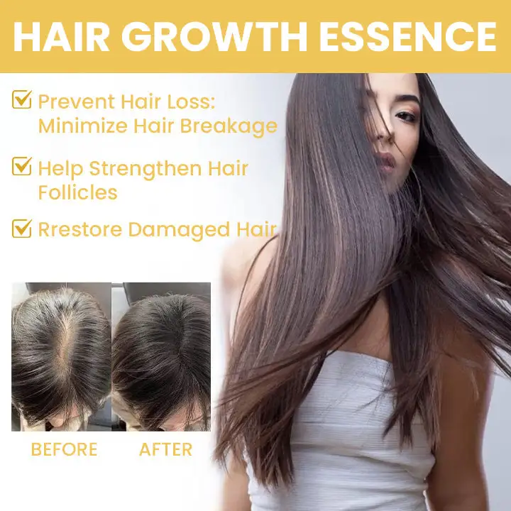 Spray-on Hair Growth Essence - Image 4