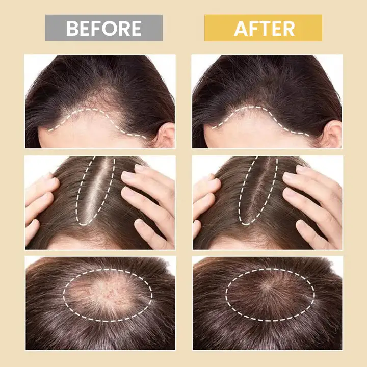 Spray-on Hair Growth Essence - Image 5