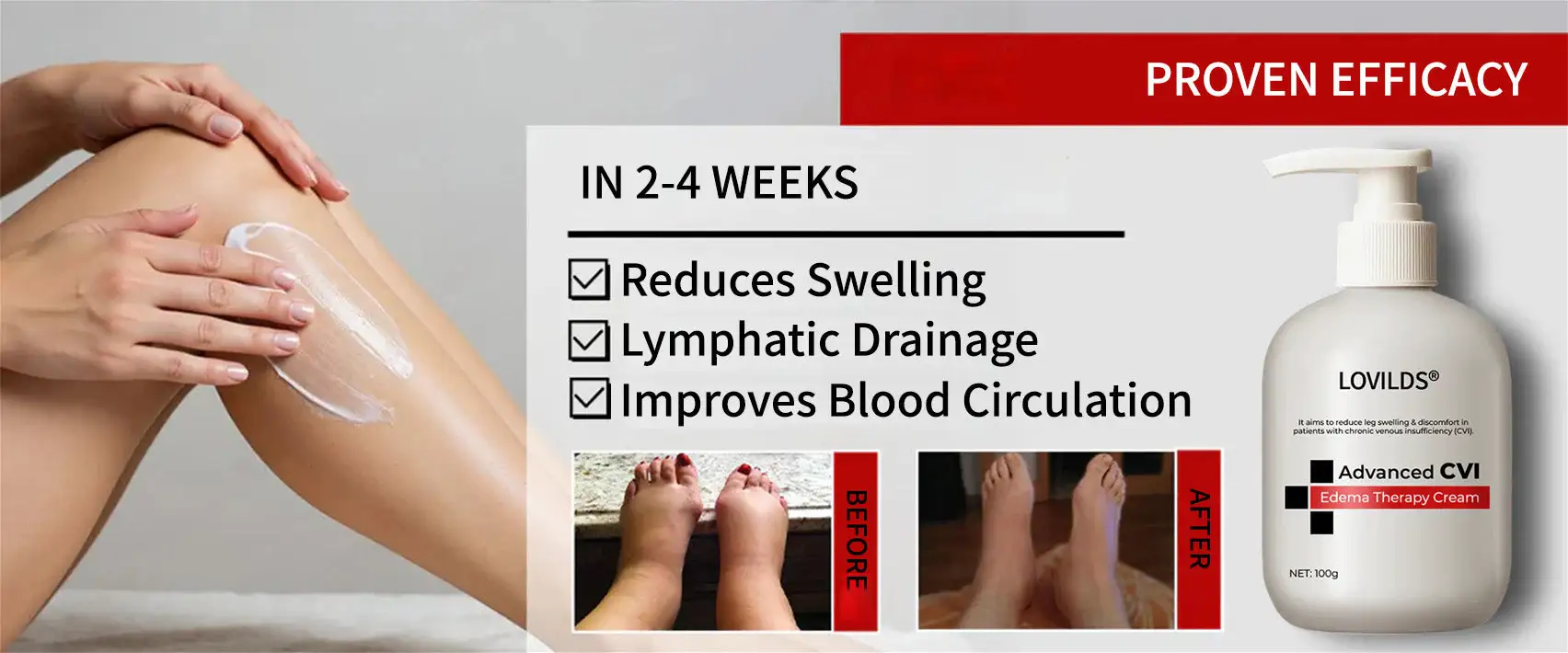 Advanced CVI Edema Restorative Cream - Image 4