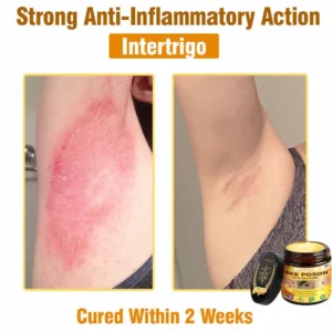 Alternative view of BEE POSON All-in-One Cream