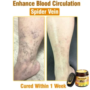 Alternative view of Bee Poison All-in-One Cream US Dermatologist Approved