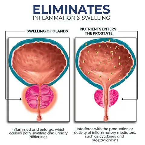 BeeProsta Nasal Spray for Prostate Wellness - Image 3